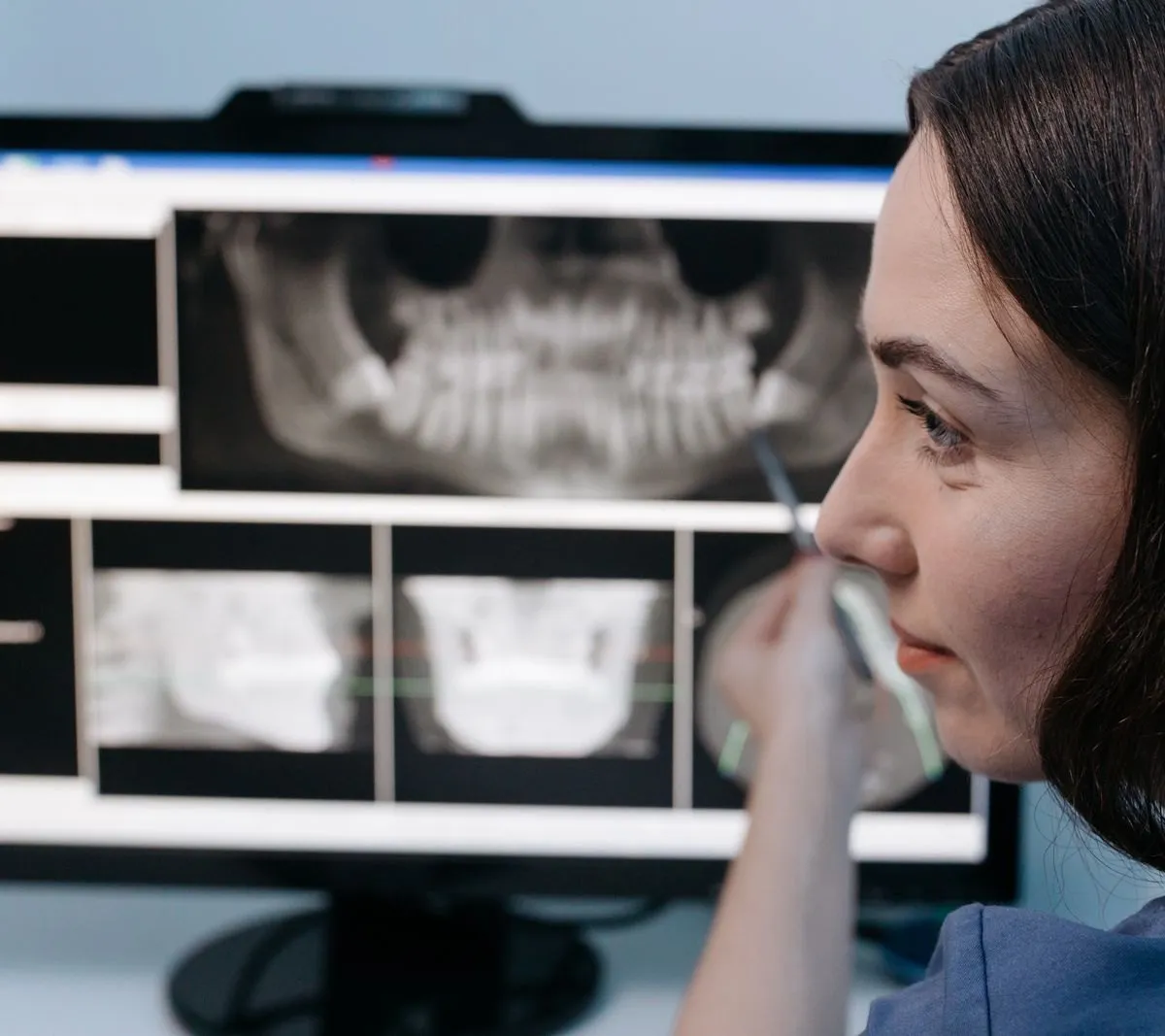 A Basic Guide to ‘Invisible Aligners’