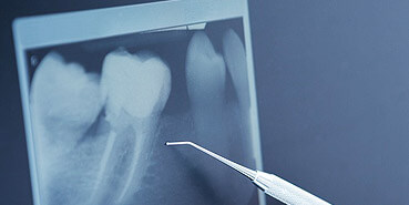 Dental Imaging Service