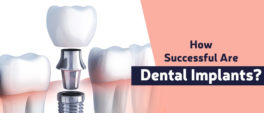 How successful are dental implants?